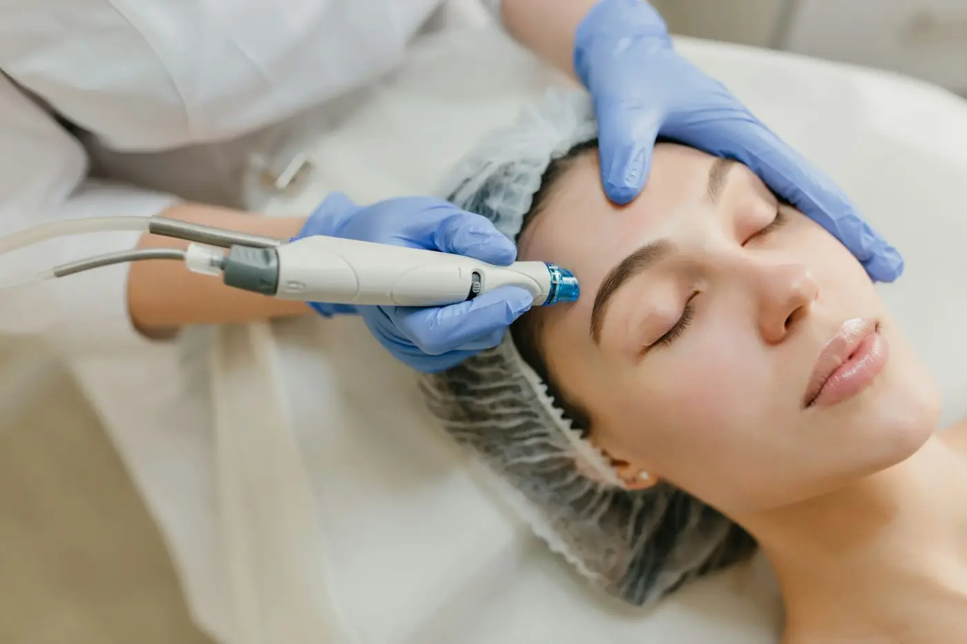 Facial peel treatment at Levirgo Aesthetics Clinic, for clients from Marylebone